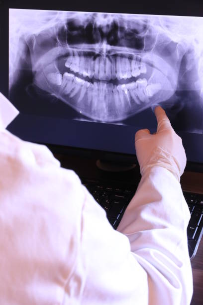 Best Emergency Tooth Extraction in Chula Vista, TX