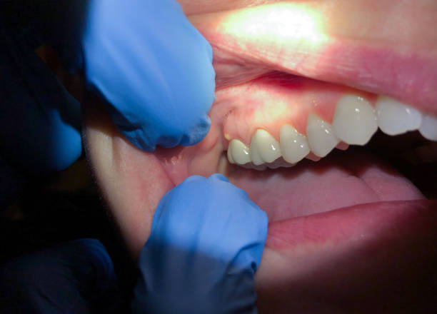 Best Urgent Care for Lost Fillings or Crowns in Chula Vista, TX